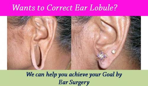 Ear Surgery